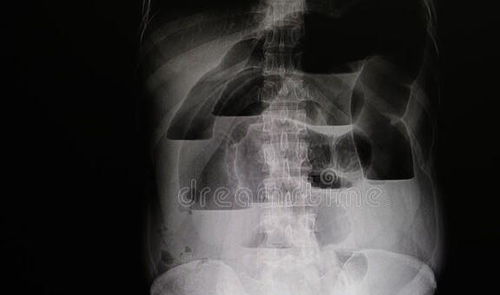 健康之路腹泻与结肠炎有关吗